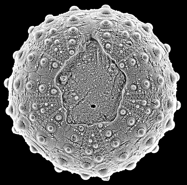 Phymosoma ravni