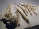 Stereocidaris pistillum mit Stacheln