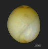 Globulina sp.